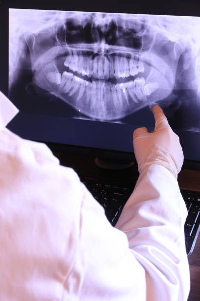 Best Broken or Chipped Tooth Repair in Avalon, PA